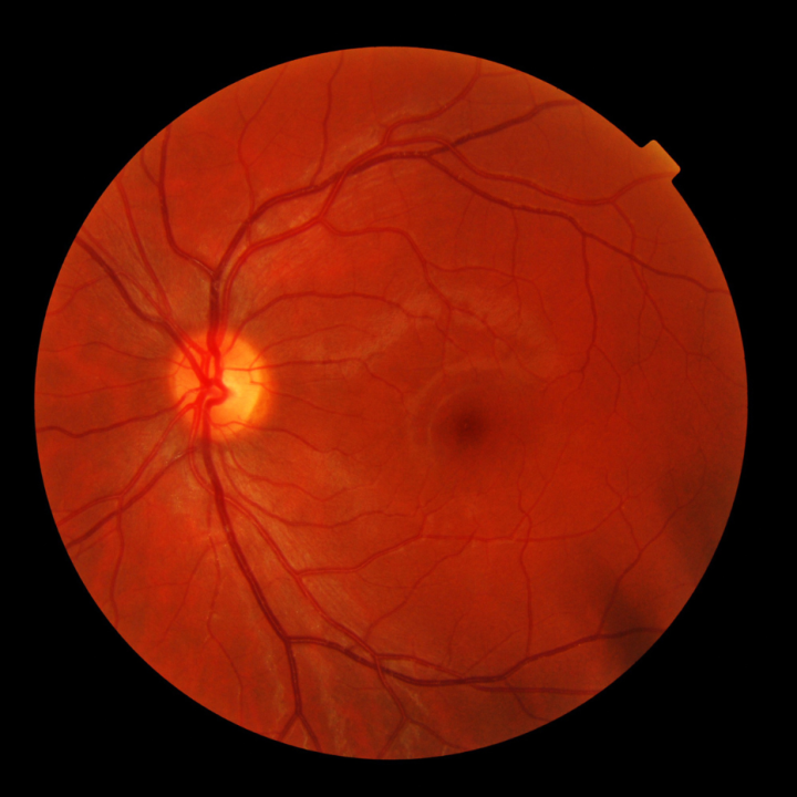 Imagery of a retina scan