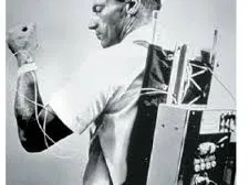 man with first wearable insulin pump